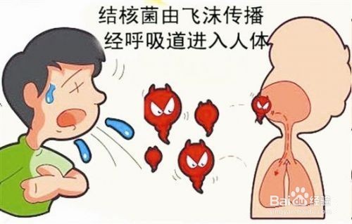 如何預(yù)防肺結(jié)核？